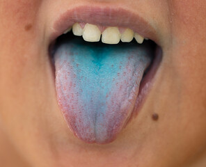 Obraz premium blue tongue in a child from dyes