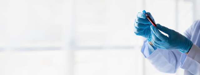 Lab assistant, a medical scientist, a chemistry researcher holds a glass tube through the blood...
