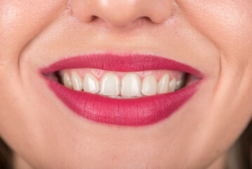 Open Mouth On Woman Face with Pretty Smile and White Teeth. Use Bright Red Lipstick.
