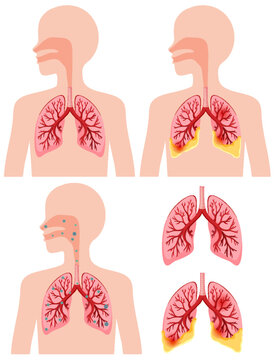 Human lungs icons collection