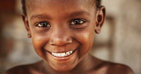 Close Up Portrait of a Shy Authentic African Boy Smiling and Laughing at the Camera with a Blurred Background. Black Male Kid Representing Future, Hope, and Acceptance. Documentary Footage