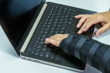 Woman hand in black orthosis is working on computer. A freelancer with one broken wrist typing on laptop computer on keyboard.
