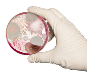 Hand in glove holding Petri dish with bacteria