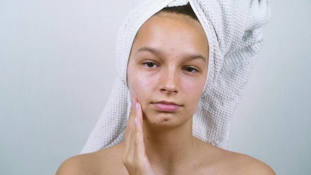 Adolescent girl with bath towel on head looking at camera and applying face cream on cheek. Time lapse pensive teenager with acne problems taking care of her skin. Concept of beauty