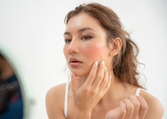 woman are worried about faces Dermatology and allergic to steroids in cosmetics. sensitive skin,...