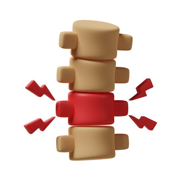 Spinal injury 3d illustration