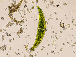 Freshwater Closterium algae (unicellular charophyte green algae) - optical microscope x200...