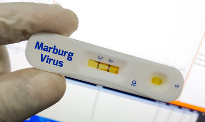 The doctor holding test cassette for Marburg virus test, Medicine and healthcare concept