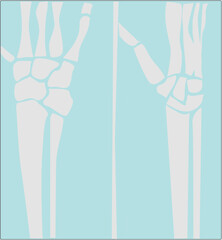 Obraz na płótnie Canvas Radiography of a human hand illustration 