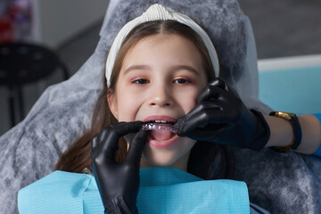 caucasian little kid girl invisible aligner and pointing to her perfect straight teeth. Dental...