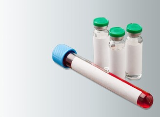 Blood test tube for virus detection