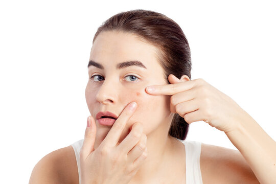 Woman has a problematic skin. She squeezing pimple on her face. Close-up photo on a white background