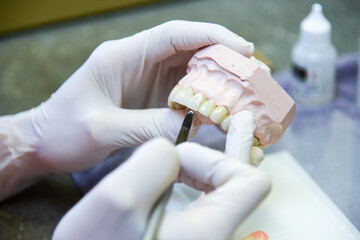 Zahntechnik Zahnarzt Prothese Gebiss  