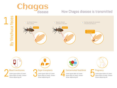 Infographic on how chagas disease is transmitted: bites, blood transfusion, organ transplants, contaminated food or pregnancy.
