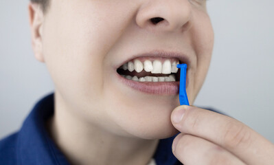 Interdental brush. A man shows a brush for cleaning the interdental space. Brush for cleaning teeth and daily oral care. Dentistry and orthodontics 