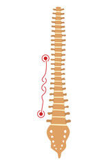 Spinal deformity. Symbol of spine curvatures or unhealthy backbones. Human spine anatomy, curved spine. Diagram with marked section. Body posture defect