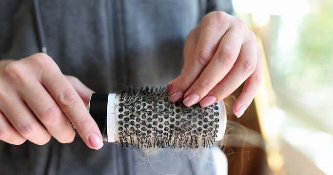 Female hands holding hairbrush with hair loss