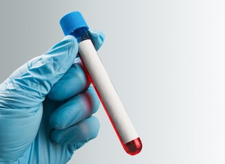 Doctor hand hold sample tube for blood test