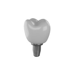 dental teeth implant