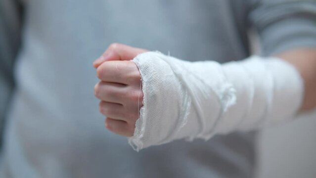 The broken arm of a man in gaps. Plaster cast on a broken arm close-up.