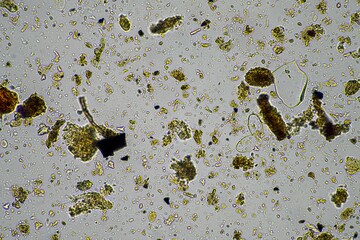 soil microorganisms in a soil sample, soil fungus and bacteria on a regenerative farm in compost. fungi hyphae in a soil test.