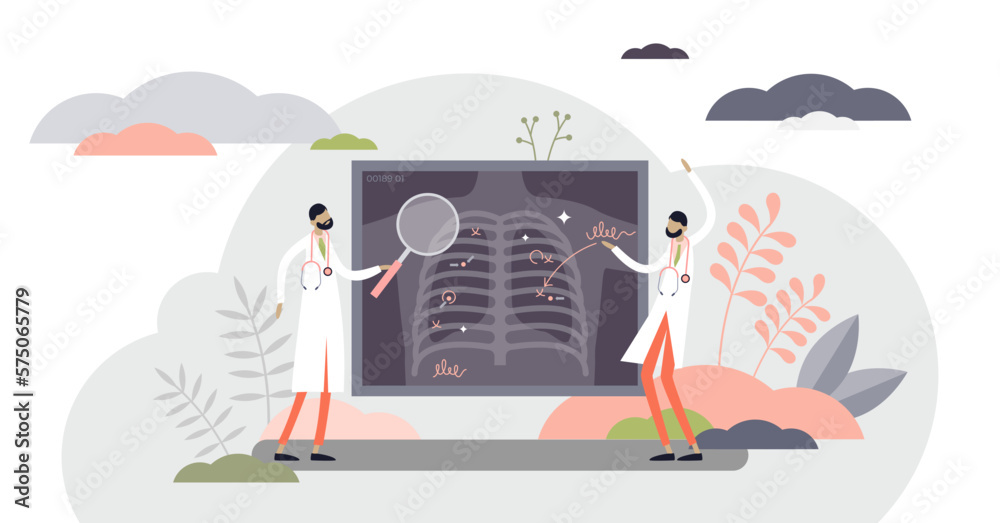 Wall mural Lung health illustration, transparent background. Covid-19 x-ray flat tiny persons concept. Hospital radiology results research and problem recognition. Pulmonary pneumonia or cancer in trachea.