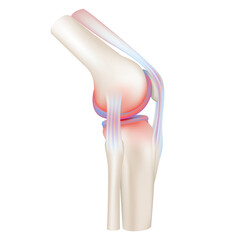 Human bone anatomy. Arthritis knee joint, Pain leg. Skeleton x ray scan. Medical concept. Realistic 3D File PNG.
