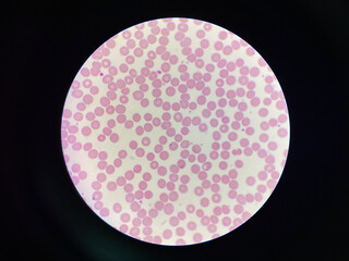 Normalchromic normocytic red blood cell.