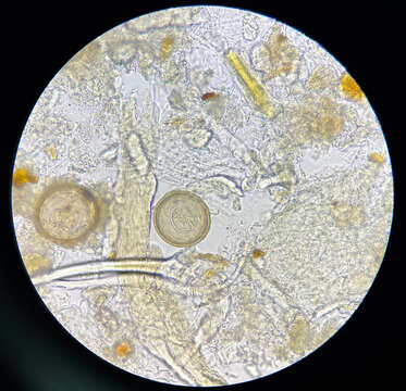 hymenolepis diminuta egg human parasite in stool examination.