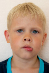 Portrait of a boy with a swollen lip from an insect bite