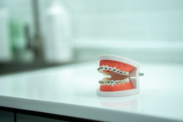 tooth model with metal wire dental braces, dental tooth dentistry.