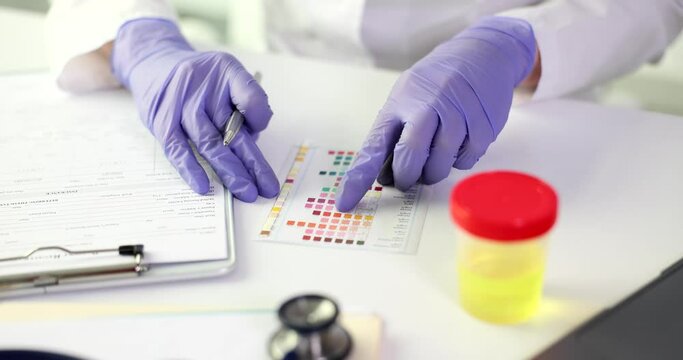 Woman makes urine test with ph material in laboratory