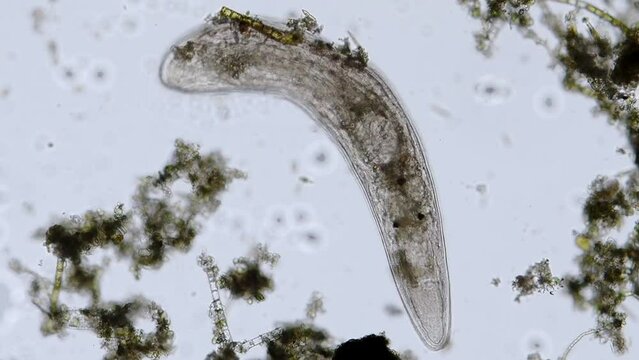 freshwater flatworm Turbellaria under the microscope - optical microscope x100 magnification