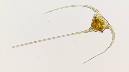 Ceratium sp, a marine phytoplankton from dinoflagellata group. Lugol preserved sample. 400x...