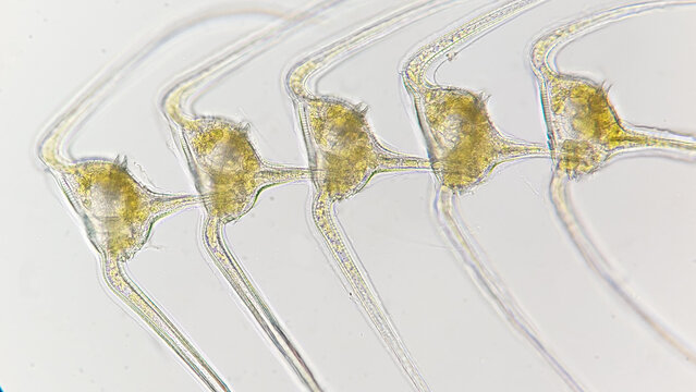 Colony of marine dinoflagellate, Ceratium vulture. Lugol-preserved sample. 400x magnification