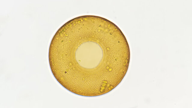 Testate amoeba, an amoeba with a smooth shell. Genus Arcella. Lugol fixed sample. 400x objective. selective focus