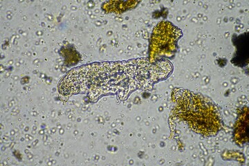 soil microorganisms including nematode, microarthropods, micro arthropod, tardigrade, and rotifers a soil sample, soil fungus and bacteria on a regenerative farm in compost under the microscope.