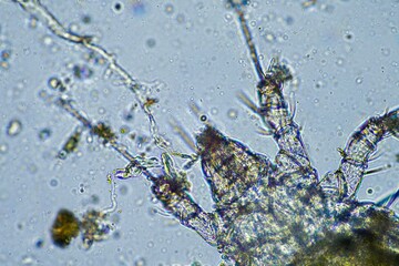 	
soil fungi and microorganisms in a soil and compost sample	
