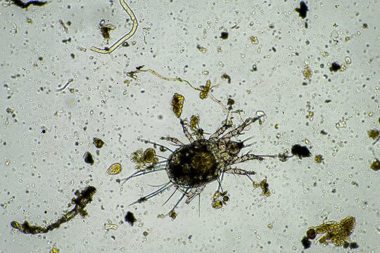 soil parasite in a sample under the microscope on a farm in Australia 