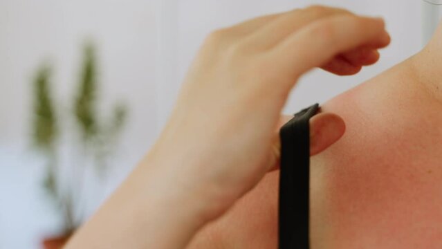 Woman removes black bra strap from shoulder with reddened, irritated skin, close-up. Pale patch of skin after sunburn. Unrecognizable person gently touches sunburned skin with hand, slow motion.