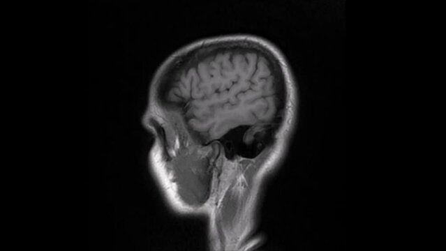 MRI of the brain. Medical image for the study of internal organs and tissues, video.