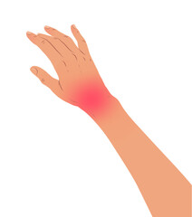 Vector illustration of hand with carpal tunnel syndrome