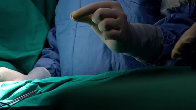 4K close-up electrocautery cosmetic surgery footage. Doctors operating and nurse handing equipment. Surgeons burning skin with heated instrument. Smoke rising out from surgical site. Stock video.