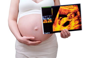 A pregnant woman holds an ultrasound with an unborn child, a studio photo, isolated on a white background