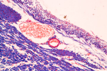 Adipose tissue human, Soft palate human, Bone human and Striated (skeletal) muscle human under the...