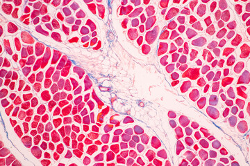 Adipose tissue human, Soft palate human, Bone human and Striated (skeletal) muscle human under the microscope in Lab. - obrazy, fototapety, plakaty