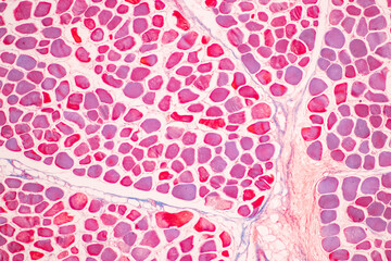 Adipose tissue human, Soft palate human, Bone human and Striated (skeletal) muscle human under the...