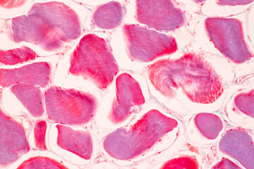 Adipose tissue human, Soft palate human, Bone human and Striated (skeletal) muscle human under the microscope in Lab.