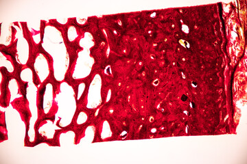 Adipose tissue human, Soft palate human, Bone human and Striated (skeletal) muscle human under the...