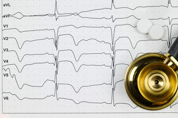 ECG. Myocardial infarction on ECG in chest leads V1-V6, stethoscope and pills for treatment....